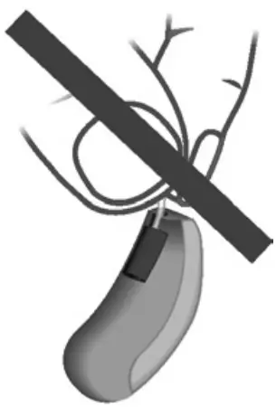 AUDIO SERVICE Hearing Instruments - receiver