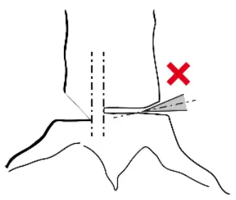 Funk Titan 80 EDER Felling Wedge - Wrong 2