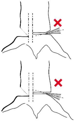Funk Titan 80 EDER Felling Wedge - Wrong