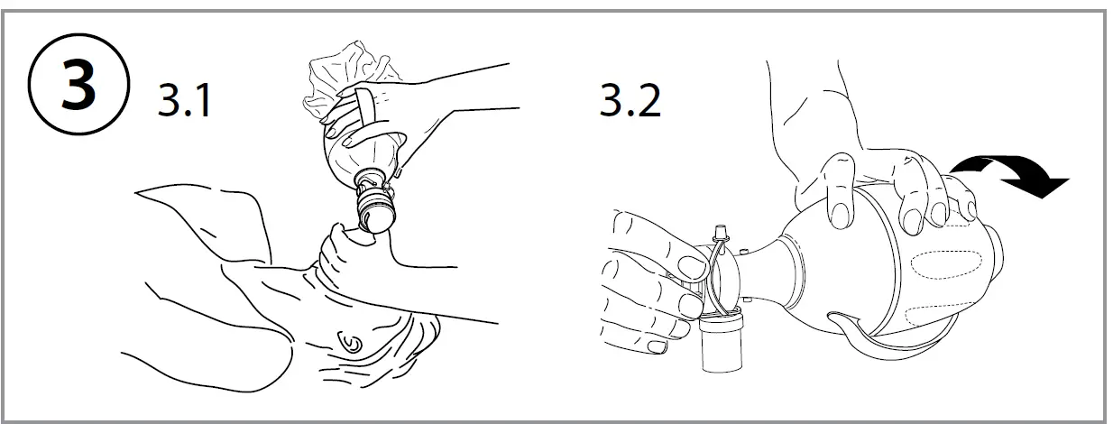 Gima-Ambu-SPUR -II-Disposable-03
