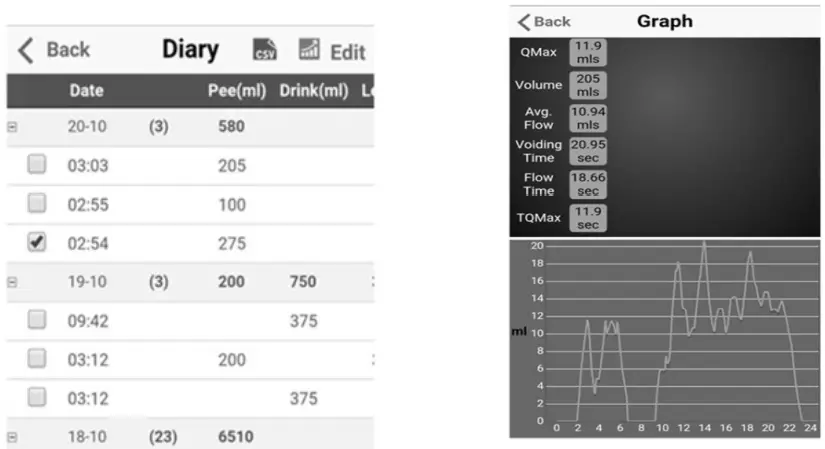 iUFlow ART-003 Perfect Bladder Tracking Uroflowmetry and Real time Data-FIG15