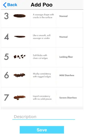 iUFlow ART-003 Perfect Bladder Tracking Uroflowmetry and Real time Data-FIG21