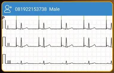 EDAN-SE-1200-Pro-Express-Basic-ECG-Machine-fig- (3)