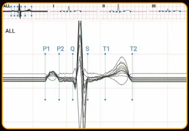 EDAN-SE-1200-Pro-Express-Basic-ECG-Machine-fig- (4)