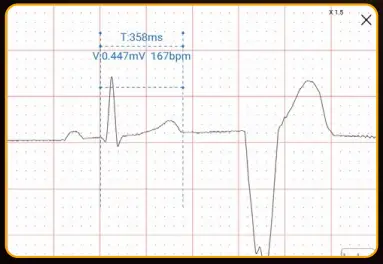 EDAN-SE-1200-Pro-Express-Basic-ECG-Machine-fig- (5)