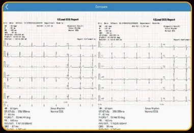 EDAN-SE-1200-Pro-Express-Basic-ECG-Machine-fig- (6)