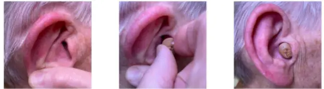 The Hearing CIC Hearing Aids - Inserting Your Hearing Aids 2