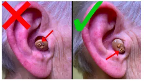 The Hearing CIC Hearing Aids - Inserting Your Hearing Aids 3