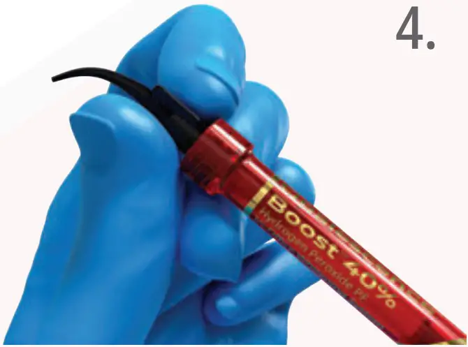 ULTRADENT Opalescence Boost PF 40% In Office Power Whitener - fig 4