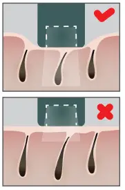 Ulike-A2-Air-IPL-Hair-Removal-Device-fig-18