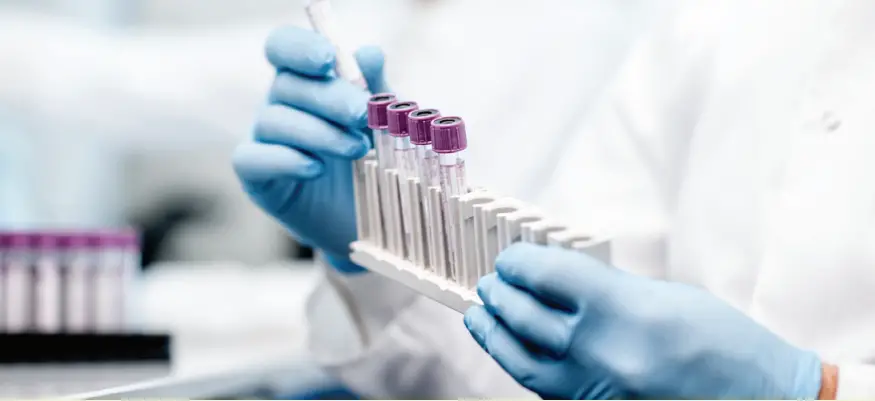 Quest Diagnostics Genetic Insights Test A1