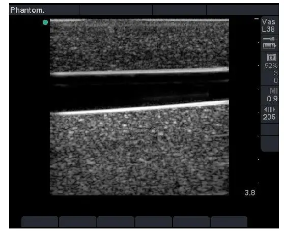 CAE-BPA304-HP-Gen-II-PICC-PIV-and-Arterial-Line-Vascular-Access-Ultrasound-Training-Model-2