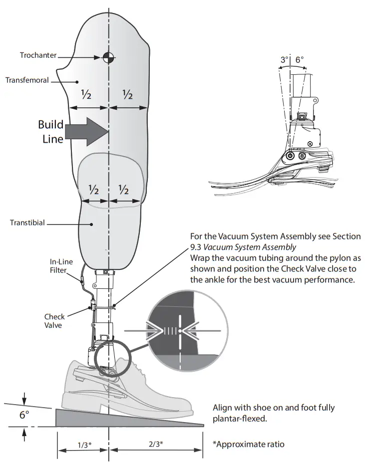 Blatchford EVAC22L1S Medical Equipment - Alignment