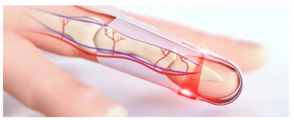 MASiMO-PLM-14346A-Pulse-Oximetry-and-Skin-Pigmentation-fig-2