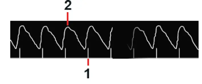 Masimo-W1-Advanced-Health-Tracking-Watch-21