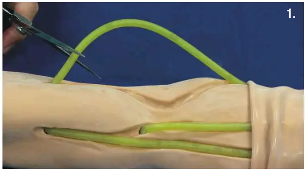 Nasco HEALTHCARE IV Training Arm and Hand Unit - Remove skin