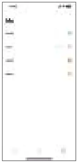 ALKAI N27 Smart Watch - Set