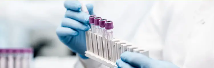 Quest Diagnostics Hereditary Thrombophilia