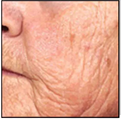 Avance Beauty IPL350 SCR E Light Flux Professional IPL Scar Reduction System - IPL Resurfacing 1