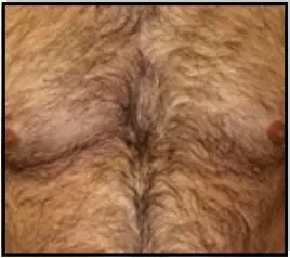 Avance Beauty IPL350 SCR E Light Flux Professional IPL Scar Reduction System - Qualifications 1