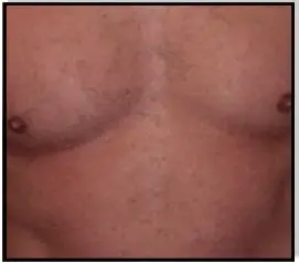 Avance Beauty IPL350 SCR E Light Flux Professional IPL Scar Reduction System - Qualifications 2