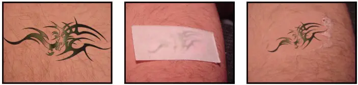 Avance Beauty IPL350 SCR E Light Flux Professional IPL Scar Reduction System - Tattoo Removal 1