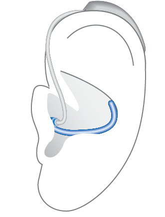 Miracle-Ear-ENERGY-5-4-3-2-BTE-R-S-Hearing-07