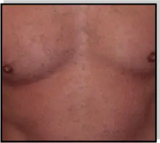 Avance Beauty IPL350-HR - Client Pre-Qualifications 2