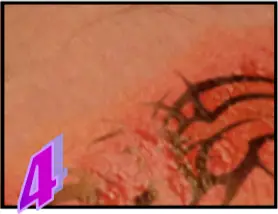 Avance Beauty - The Treatment Procedure 4