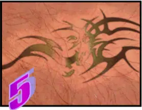 Avance Beauty - The Treatment Procedure 5