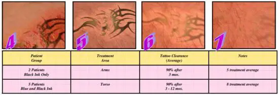 FIG 20 The Treatment Procedure.JPG