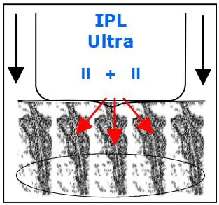 FIG 22 Discomfort and Client Reaction.JPG