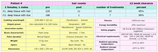 FIG 26 Important Considerations for Safe IPL Hair Removal Treatment.JPG
